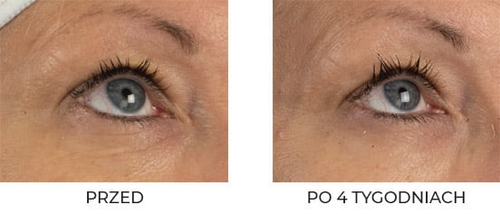 QMS Medicosmetics Day & Night 3-Step Core Routine Set Strong zestaw kolagenowy z peelingiem 10% AHA 