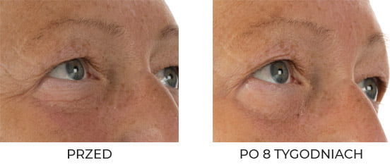 QMS Medicosmetics Day & Night 3-Step Core Routine Set Strong zestaw kolagenowy z peelingiem 10% AHA 