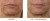 QMS Medicosmetics Day & Night 3-Step Core Routine Set Strong zestaw kolagenowy z peelingiem 10% AHA 